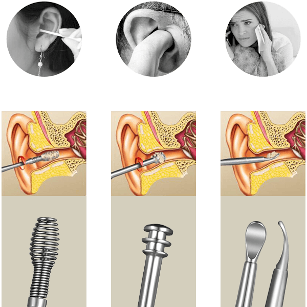 Kit de curățare a urechilor 03